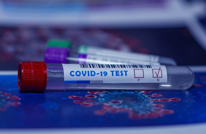  Poslednjih dana pad broja zaraženih koronavirusom; tokom avgusta više od 1000 zaraženih